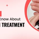Everything You Need to Know About Ivermectin Treatment